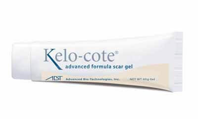 Free Kelo-cote Advanced Scar Removal Gel